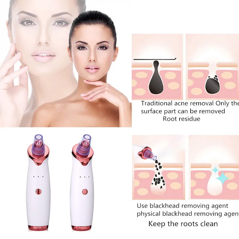 Blackhead Remover Black Dot Remover Acne Vacuum Suction