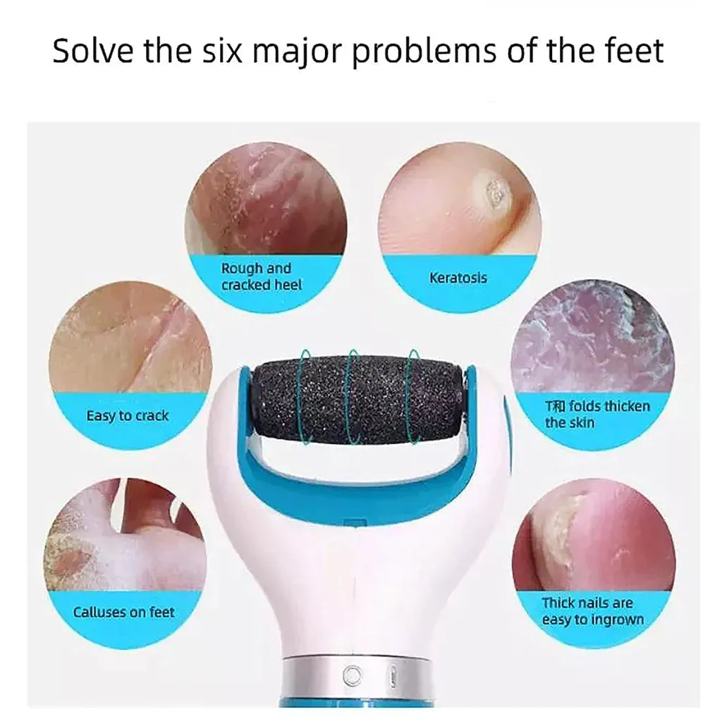 Callus Remover Pedicure Device for Women With (1 Year Warranty)